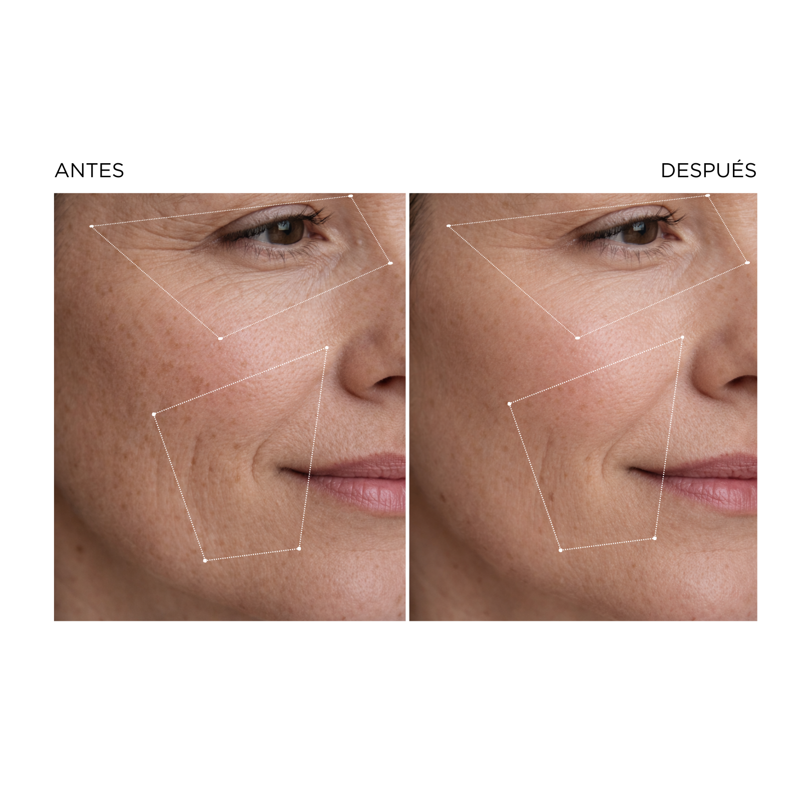SKIN FORMULA · COLÁGENO PARA PIEL · PLAN 27 DÍAS