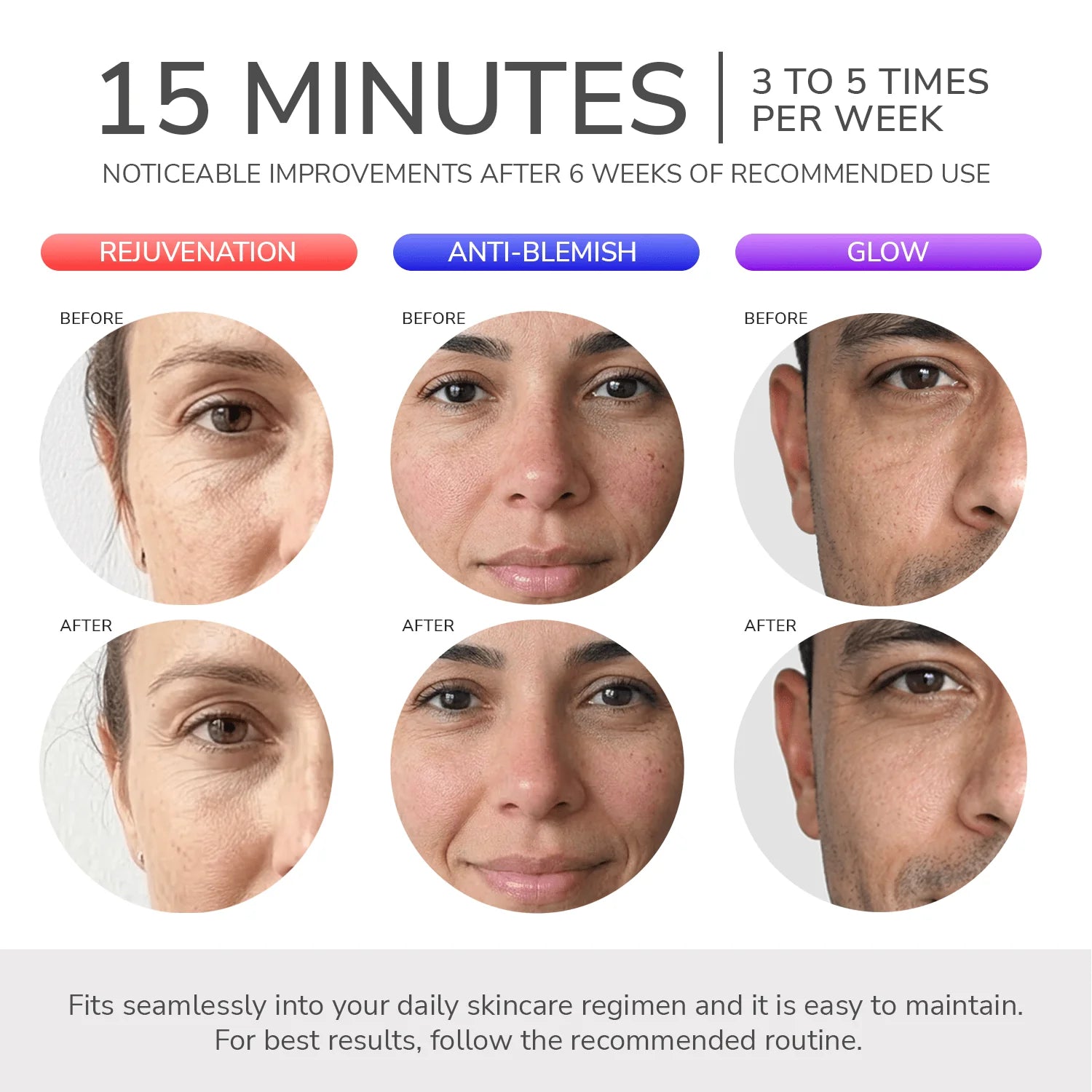 Summer Skin Edition | Plan Skin Formula 90 Días + Mascarilla LED Odelyne